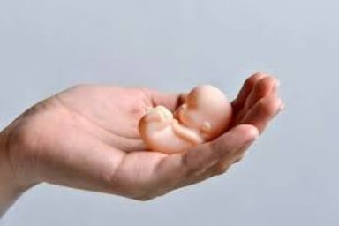 Abortus